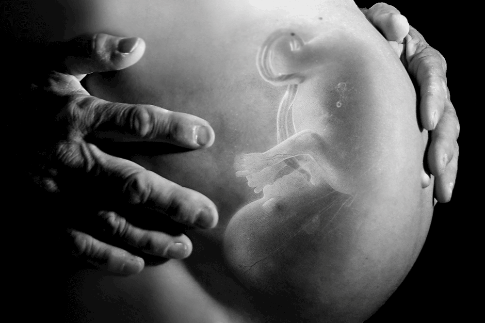 Embrioreductia - ce este si cand se recomanda - Dr. Ruxandra Albu, medic primar obstetrica - ginecologie si medicina materno - fetala. Doctor in stiinte medicale I Femmeboutiquemedical.ro